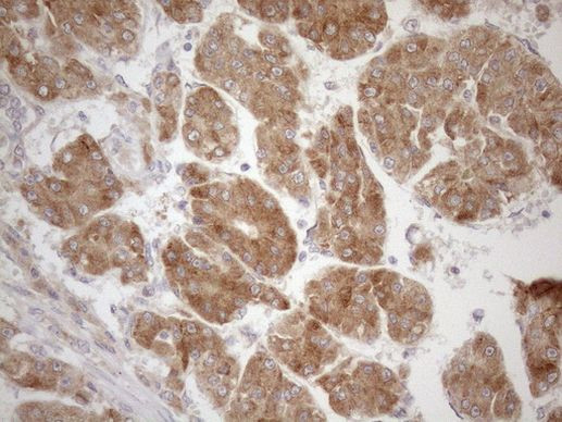 CPM Antibody in Immunohistochemistry (Paraffin) (IHC (P))