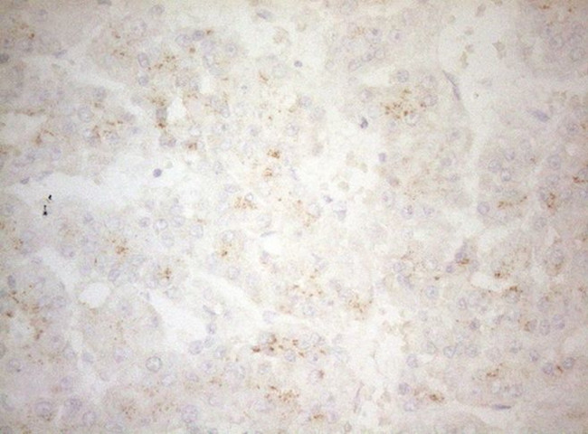 CPM Antibody in Immunohistochemistry (Paraffin) (IHC (P))