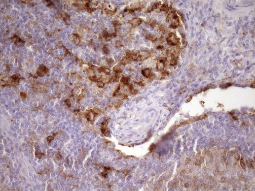 CPM Antibody in Immunohistochemistry (Paraffin) (IHC (P))