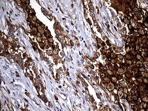 CPM Antibody in Immunohistochemistry (Paraffin) (IHC (P))