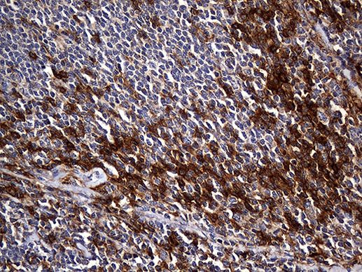 CPM Antibody in Immunohistochemistry (Paraffin) (IHC (P))