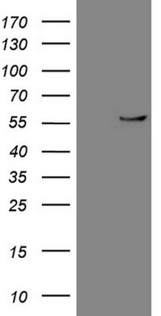 CPM Antibody in Western Blot (WB)