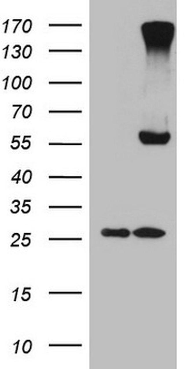 CPM Antibody in Western Blot (WB)