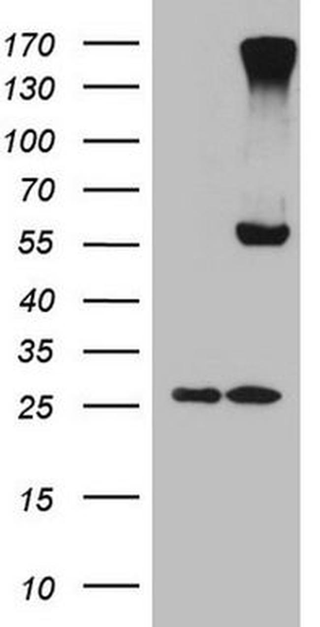 CPM Antibody in Western Blot (WB)