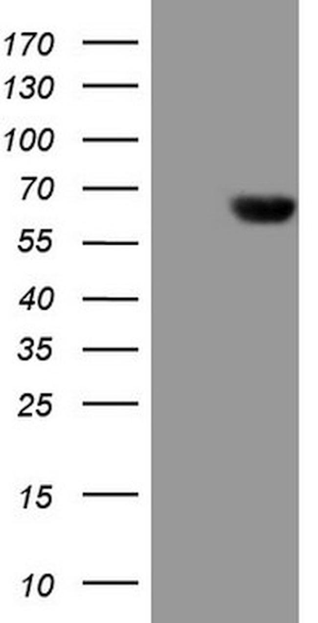 CPM Antibody in Western Blot (WB)