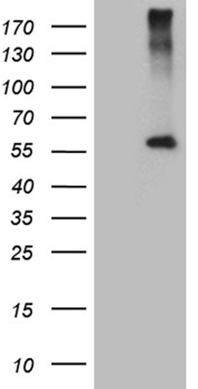 CPM Antibody in Western Blot (WB)