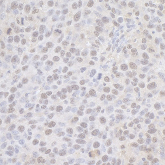 CPSF68 Antibody in Immunohistochemistry (IHC)