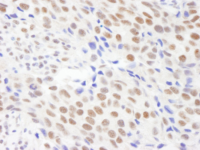 CPSF68 Antibody in Immunohistochemistry (IHC)