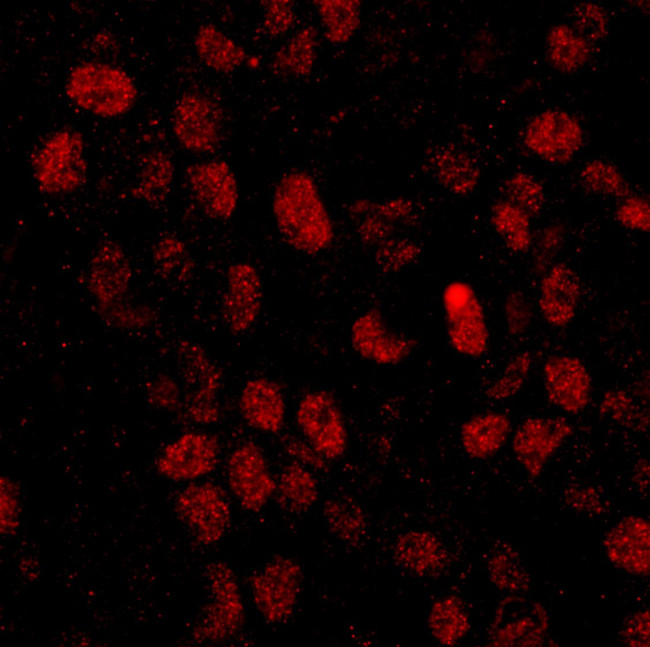 CPSF68 Antibody in Immunohistochemistry (IHC)