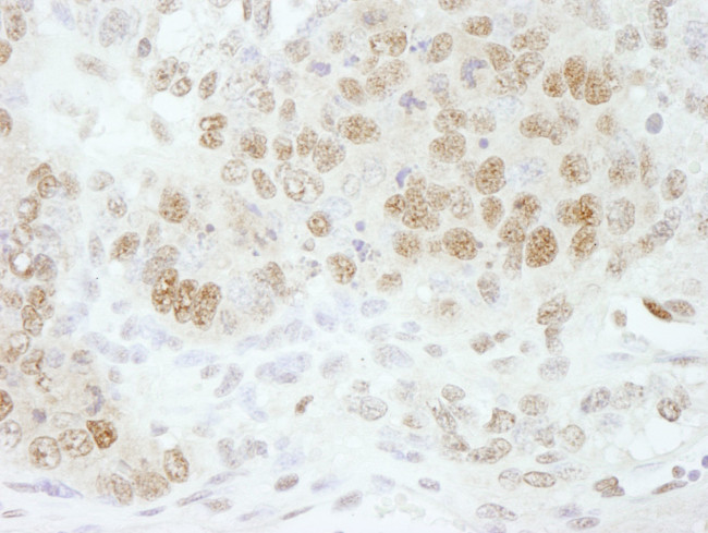 CPSF73 Antibody in Immunohistochemistry (IHC)