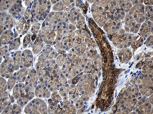 CPT1B Antibody in Immunohistochemistry (Paraffin) (IHC (P))