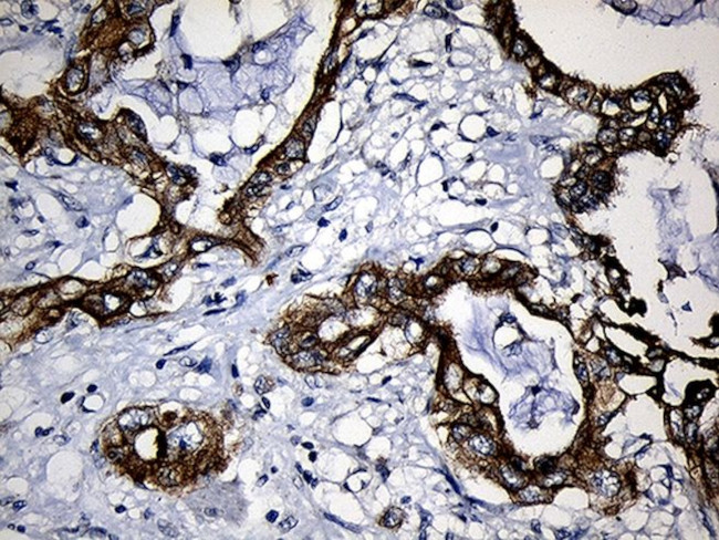 CPT1B Antibody in Immunohistochemistry (Paraffin) (IHC (P))