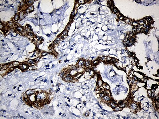 CPT1B Antibody in Immunohistochemistry (Paraffin) (IHC (P))