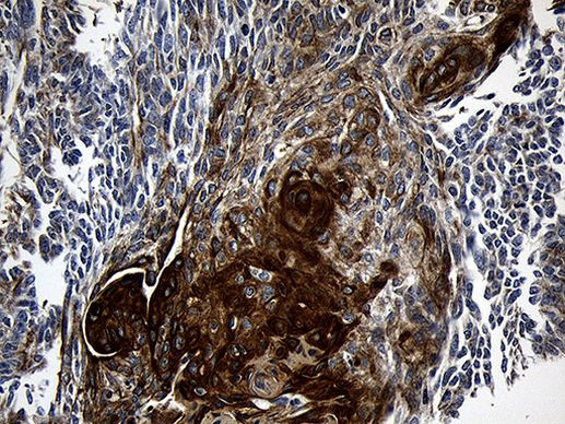 CPT1B Antibody in Immunohistochemistry (Paraffin) (IHC (P))