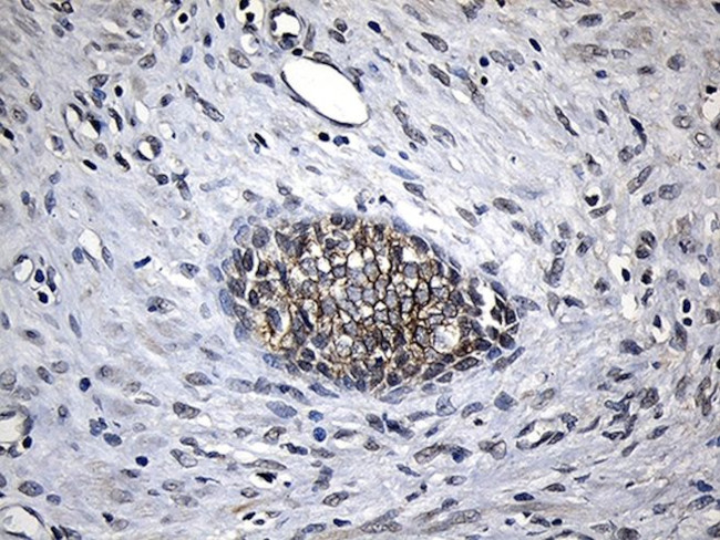 CPT1B Antibody in Immunohistochemistry (Paraffin) (IHC (P))