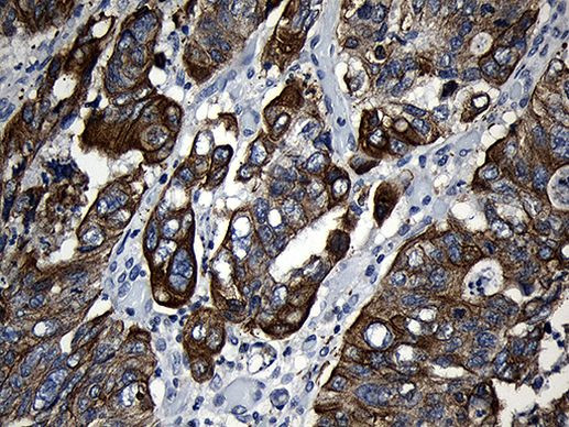 CPT1B Antibody in Immunohistochemistry (Paraffin) (IHC (P))