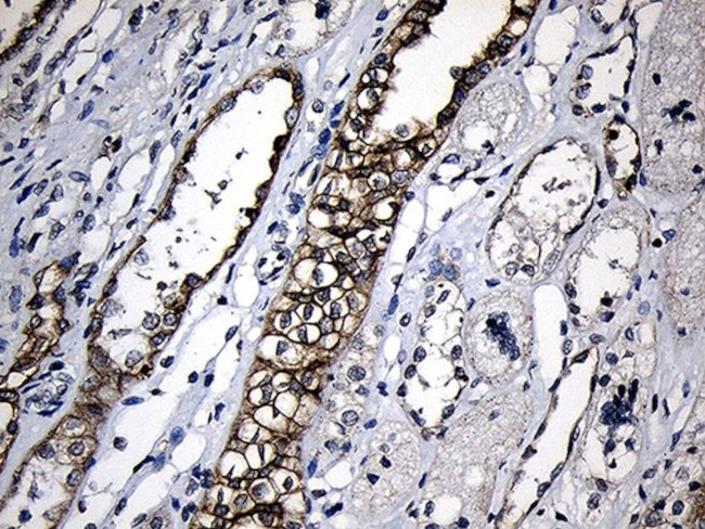 CPT1B Antibody in Immunohistochemistry (Paraffin) (IHC (P))