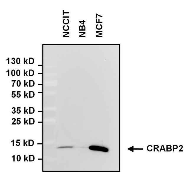 CRABP2 Antibody in Western Blot (WB)