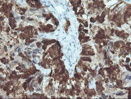 CRABP2 Antibody in Immunohistochemistry (Paraffin) (IHC (P))