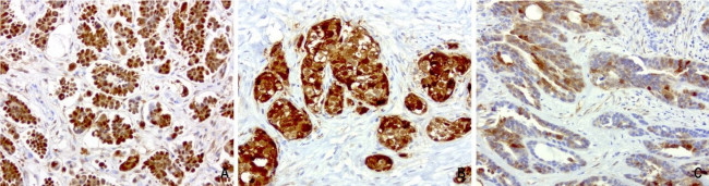 CRABP2 Antibody in Immunohistochemistry (Paraffin) (IHC (P))