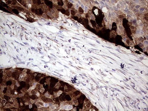 CRABP2 Antibody in Immunohistochemistry (Paraffin) (IHC (P))