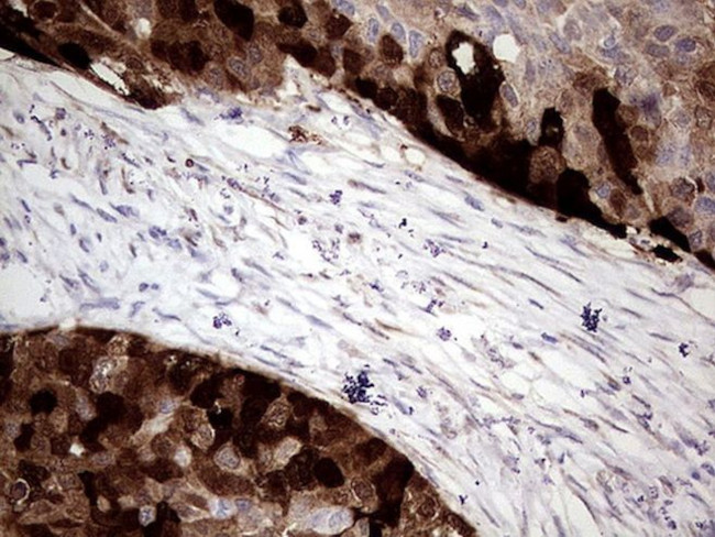 CRABP2 Antibody in Immunohistochemistry (Paraffin) (IHC (P))