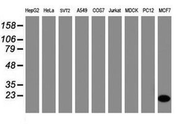 CRABP2 Antibody in Western Blot (WB)