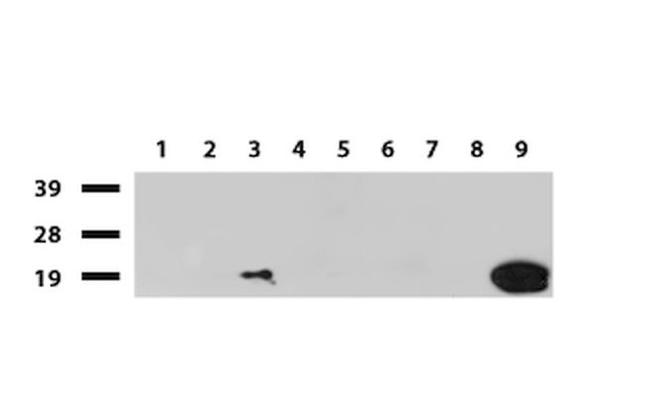 CRABP2 Antibody in Western Blot (WB)