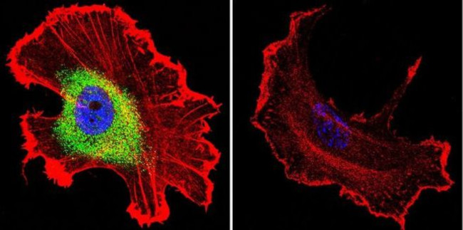 CRABP1 Antibody in Immunocytochemistry (ICC/IF)