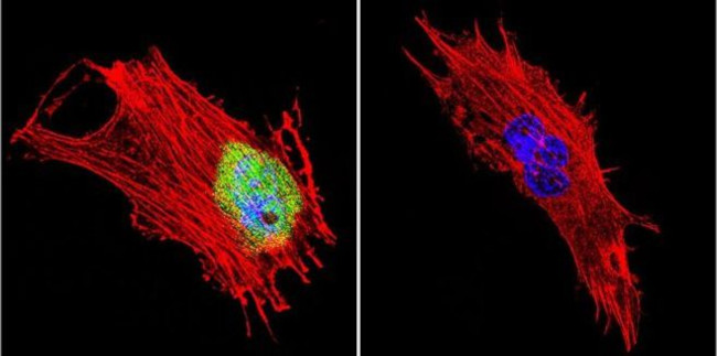 CRABP1 Antibody in Immunocytochemistry (ICC/IF)