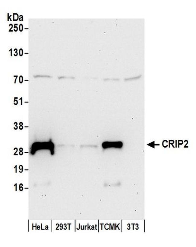 CRIP2 Antibody in Western Blot (WB)