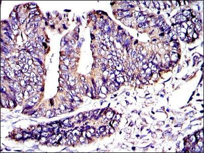 Crk Antibody in Immunohistochemistry (Paraffin) (IHC (P))