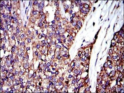 Crk Antibody in Immunohistochemistry (Paraffin) (IHC (P))