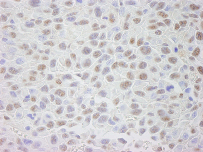 CRM1 Antibody in Immunohistochemistry (IHC)