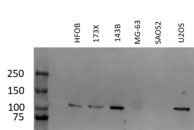 CRM1 Antibody in Western Blot (WB)