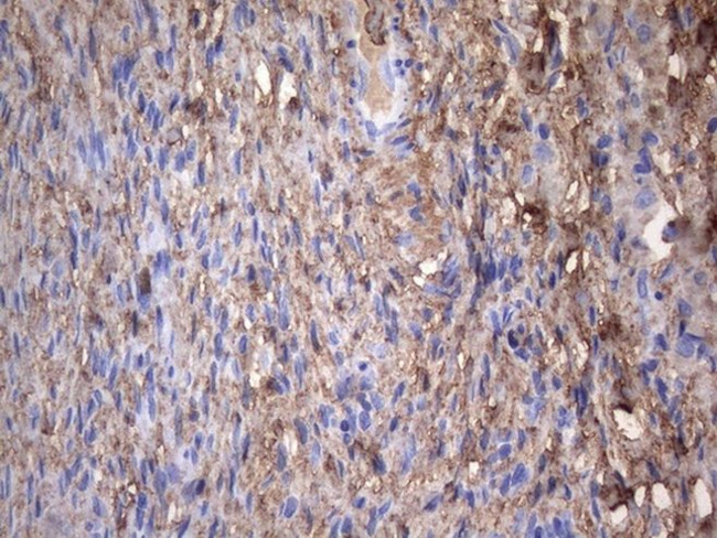 CRP Antibody in Immunohistochemistry (Paraffin) (IHC (P))