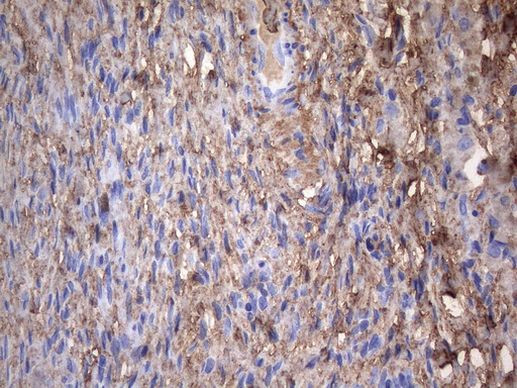 CRP Antibody in Immunohistochemistry (Paraffin) (IHC (P))