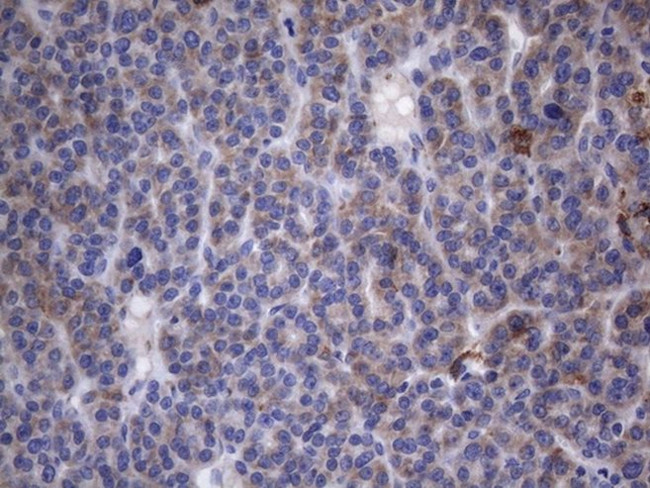 CRP Antibody in Immunohistochemistry (Paraffin) (IHC (P))