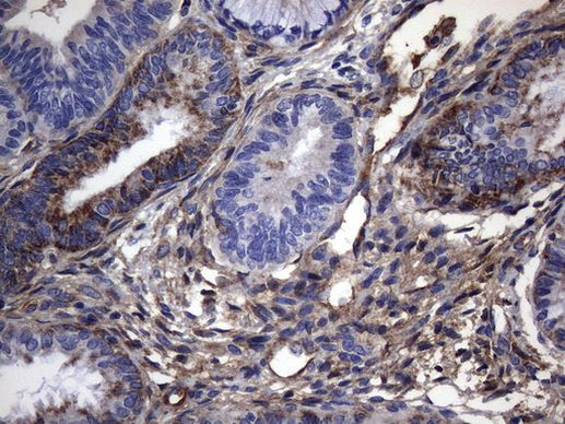 CRP Antibody in Immunohistochemistry (Paraffin) (IHC (P))