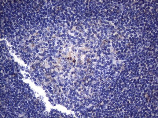 CRP Antibody in Immunohistochemistry (Paraffin) (IHC (P))