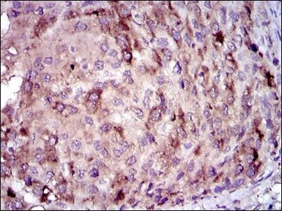 CRP Antibody in Immunohistochemistry (Paraffin) (IHC (P))