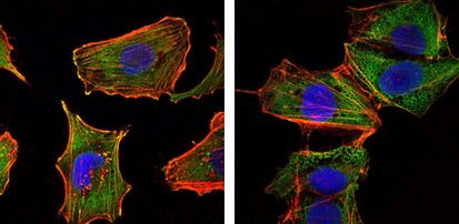 Torc1 Antibody in Immunocytochemistry (ICC/IF)