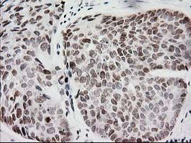 CRY2 Antibody in Immunohistochemistry (Paraffin) (IHC (P))