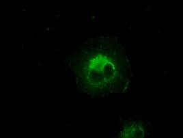 CRYAB Antibody in Immunocytochemistry (ICC/IF)