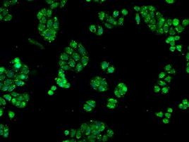 CRYAB Antibody in Immunocytochemistry (ICC/IF)