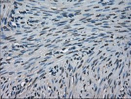 CRYAB Antibody in Immunohistochemistry (Paraffin) (IHC (P))