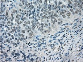 CRYAB Antibody in Immunohistochemistry (Paraffin) (IHC (P))