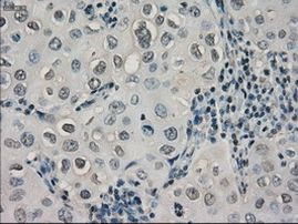 CRYAB Antibody in Immunohistochemistry (Paraffin) (IHC (P))