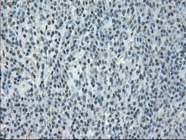 CRYAB Antibody in Immunohistochemistry (Paraffin) (IHC (P))