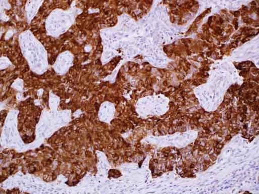 CRYAB Antibody in Immunohistochemistry (Paraffin) (IHC (P))